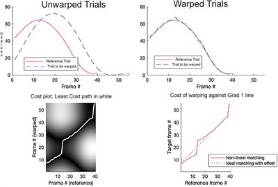 Assessment of knee flexion in young children with prosthetic knee components using dynamic time warping